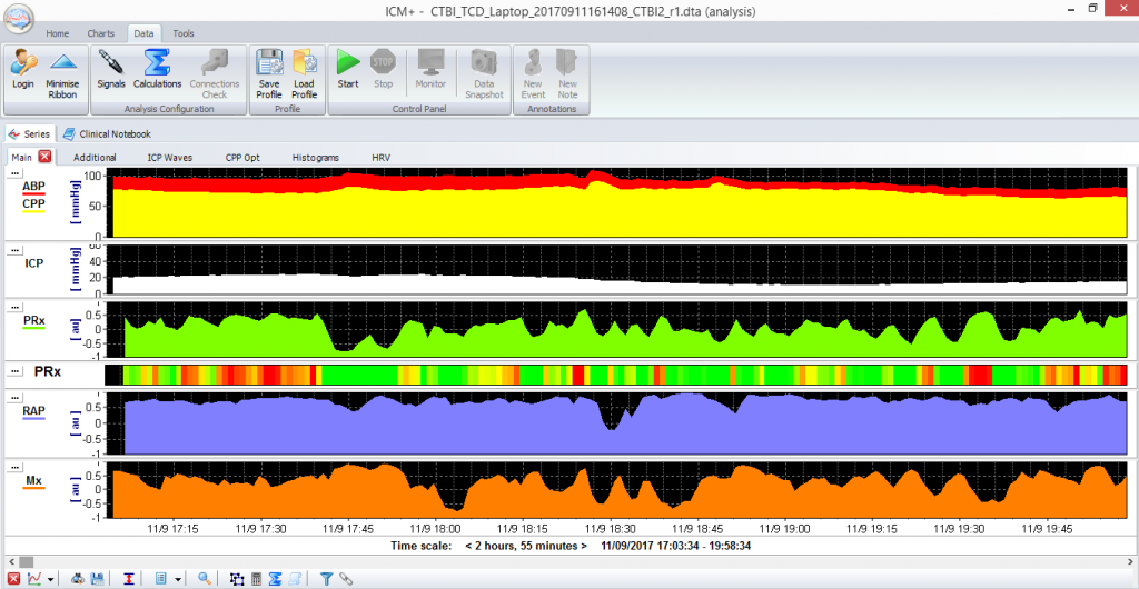 Screenshot of continuous monitoring of autoregulation and CSF compensatory reserve.